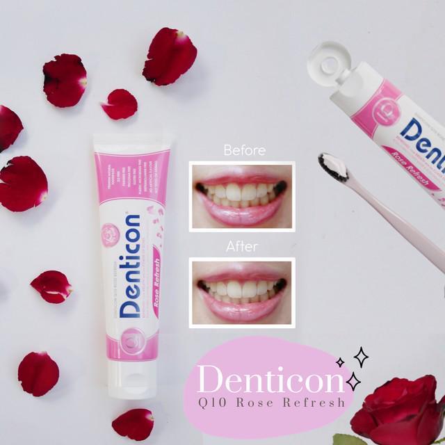 ภาพประกอบบทความ Denticon Q10 Rose Refresh ดับกลิ่นปาก เติมความมั่นใจด้วยกลิ่นหอมธรรมชาติ
