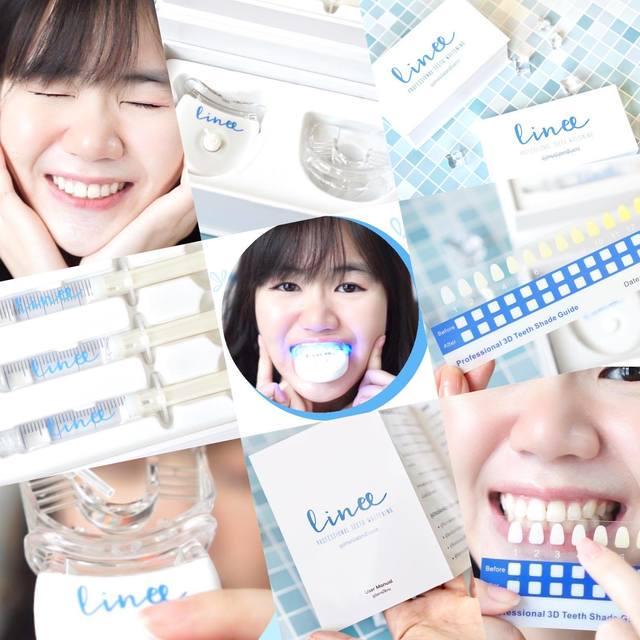 ตัวอย่าง ภาพหน้าปก:ฟอกฟันขาวที่บ้านทำได้จริงดิ่ ลองให้ Linee Professional Teeth Whitening ช่วย จะดีหรือบ้งต้องอ่าน! | ScaleGail