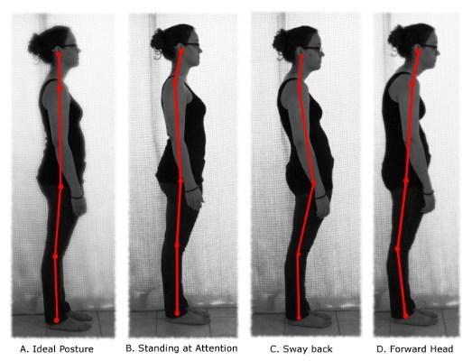 รูปภาพ:http://positivemed.com/wp-content/uploads/2013/04/standing-postures.jpg