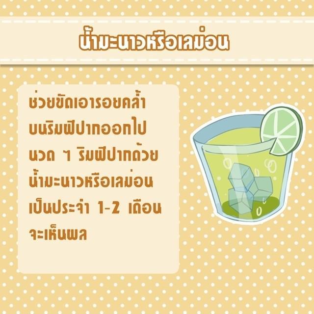 รูปภาพ: