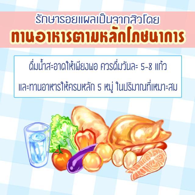 รูปภาพ: