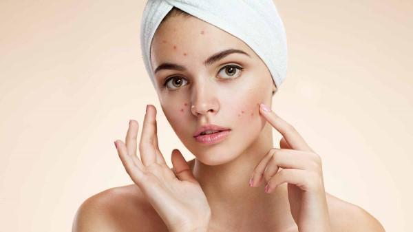 รูปภาพ:https://mahosot.com/wp-content/uploads/2016/07/acne-natural-facial-masks-diy-problem-skin.jpg