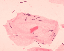 รูปภาพ:https://upload.wikimedia.org/wikipedia/commons/thumb/7/7d/Lactobacillus_sp_01.png/220px-Lactobacillus_sp_01.png