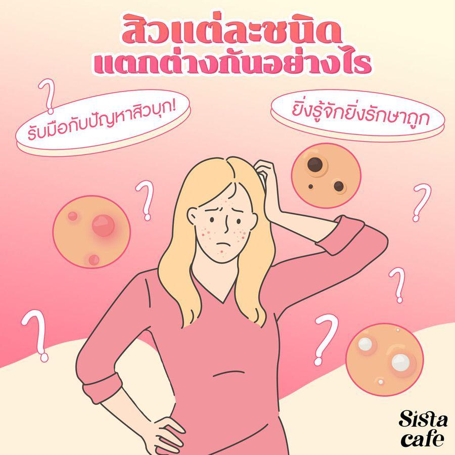 ภาพประกอบบทความ รับมือกับปัญหาสิวบุก! สิวแต่ละชนิดแตกต่างกันอย่างไร? ยิ่งรู้จักยิ่งรักษาถูก