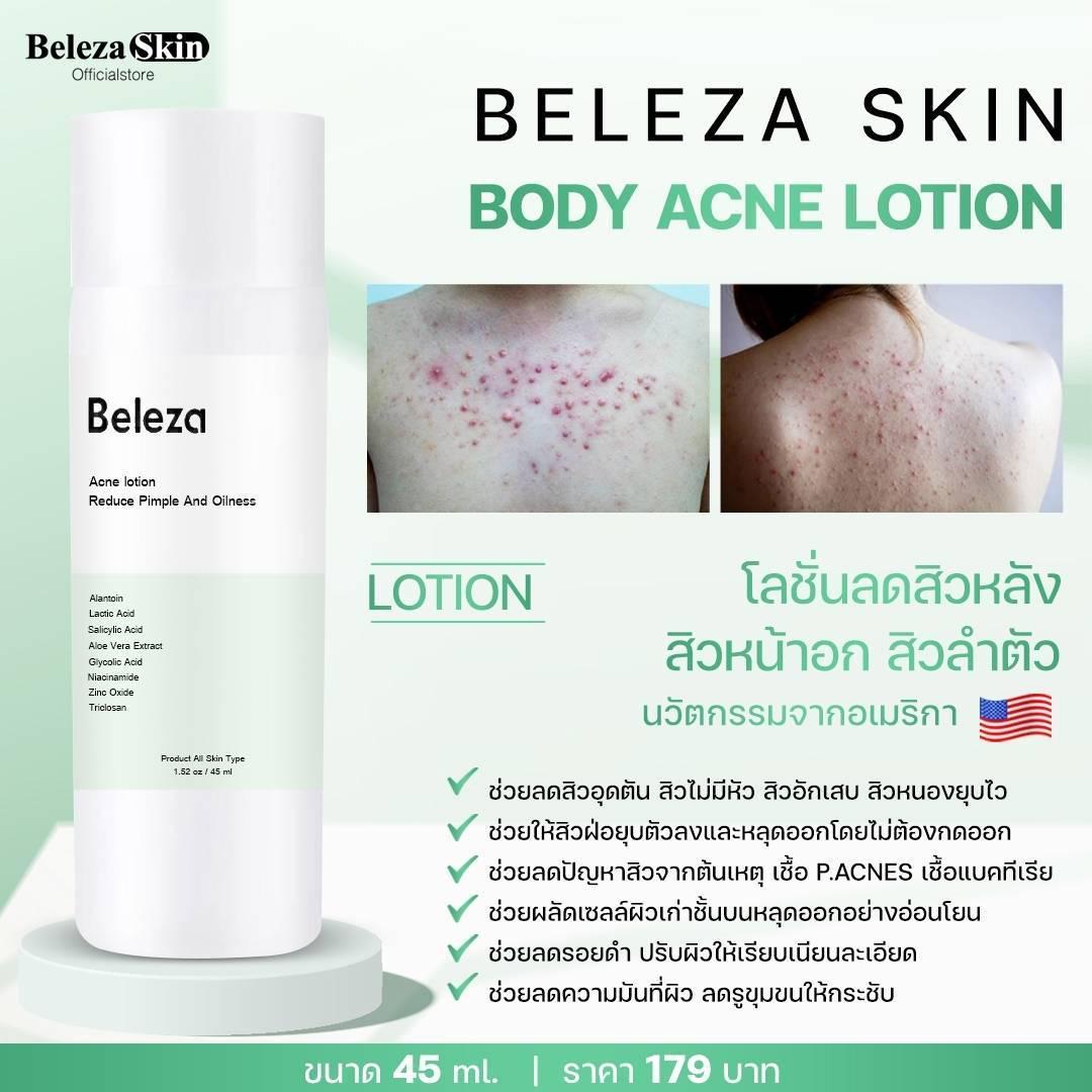 ภาพหน้าปก Beleza Skin Body Acne Lotion โลชั่นลดสิวหลัง สิวหน้าอก สิวลำตัว สิวที่ก้น แบรนด์ Belezaskinofficialstore ที่:1