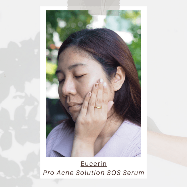 ภาพหน้าปก สยบทุกปัญหาสิวด้วย Eucerin Pro Acne Solution SOS Serum ที่:2
