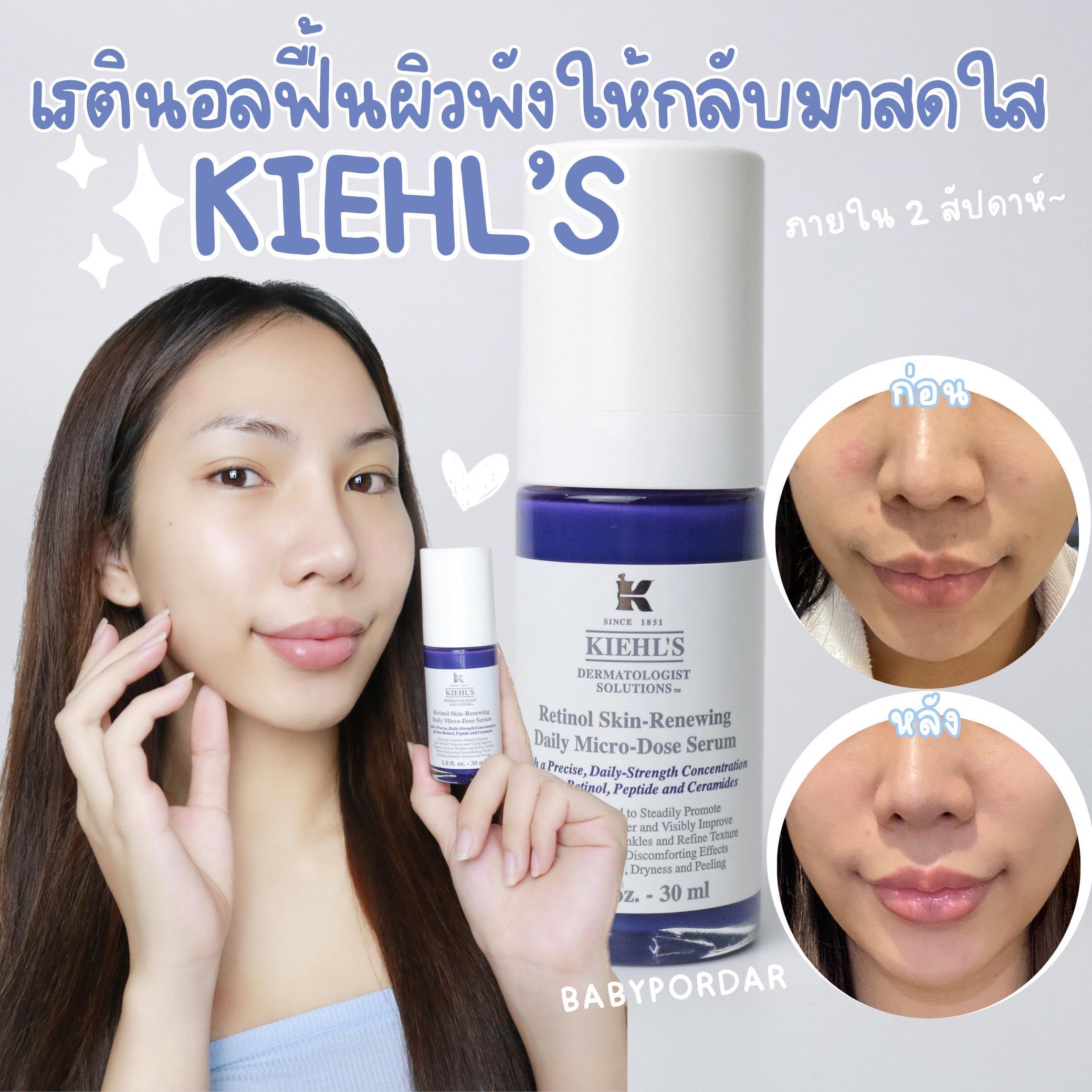 ภาพหน้าปก รีวิวเรตินอลฟื้นผิวพังให้กลับมาสดใส ใน 2 week! - Kiehl's “Retinol Skin Renewing Daily Micro-dose Serum” ที่:0