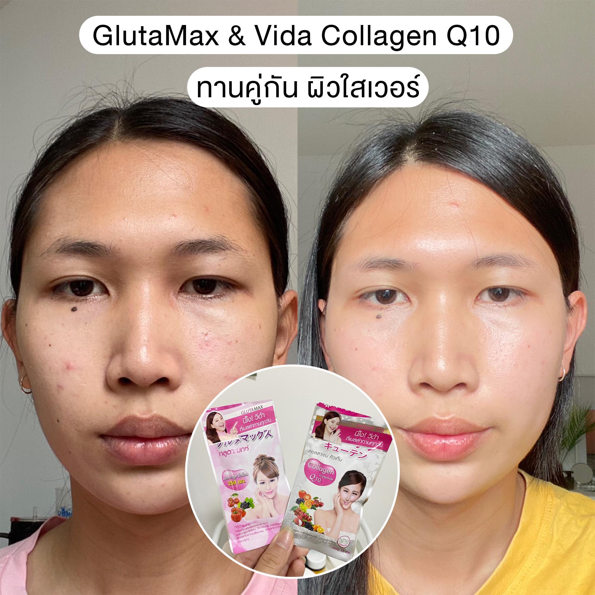 ภาพหน้าปก GlutaMax & Vida Collagen Q10 ทานคู่กัน ผิวใสเวอร์ ที่:0