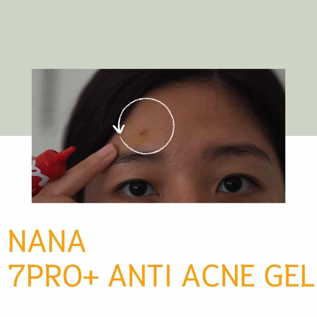 ภาพหน้าปก หยุดปัญหาสิวกวนใจด้วย Nana7Pro+ Anti Acne Gel ที่:2