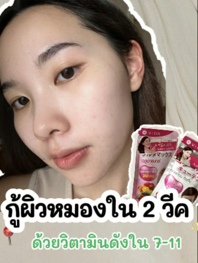 ภาพหน้าปก กู้ผิวหมองใน 2 สัปดาห์ด้วยวิตามินตัวดังใน  7-11 ที่:0