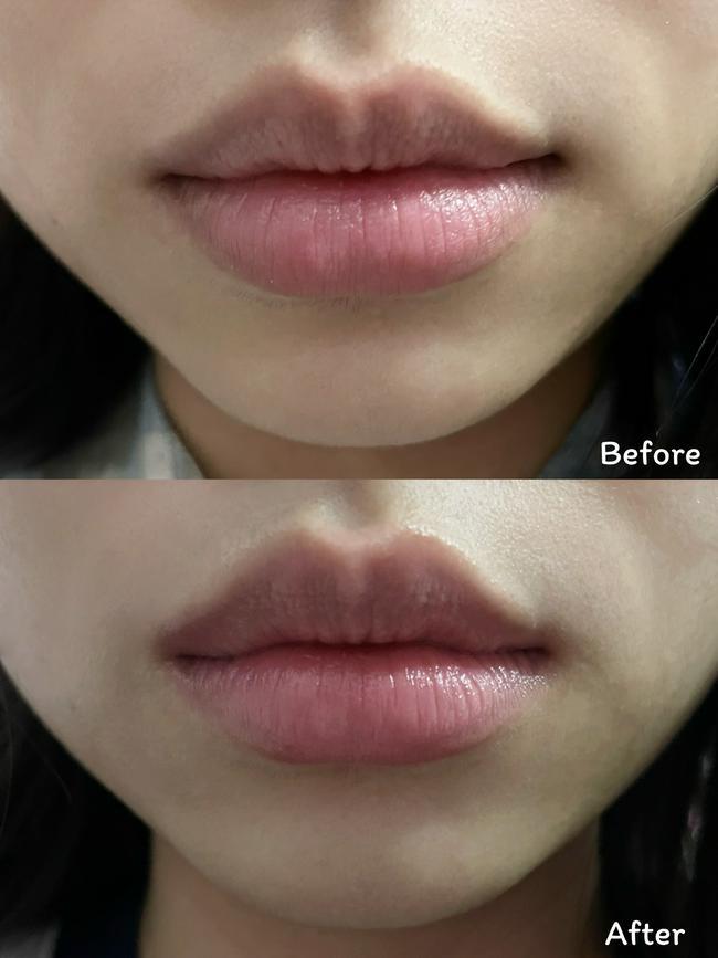 ภาพหน้าปก เภสัชกร ultra lip treatment ที่น่าร้ากกก❤️ ที่:2