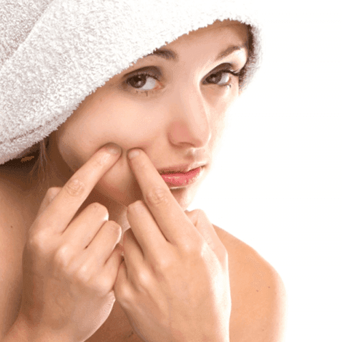 รูปภาพ:http://www.howtogetridofstuff.com/wp-content/uploads/2015/06/how-to-get-rid-of-pimples-quick.png
