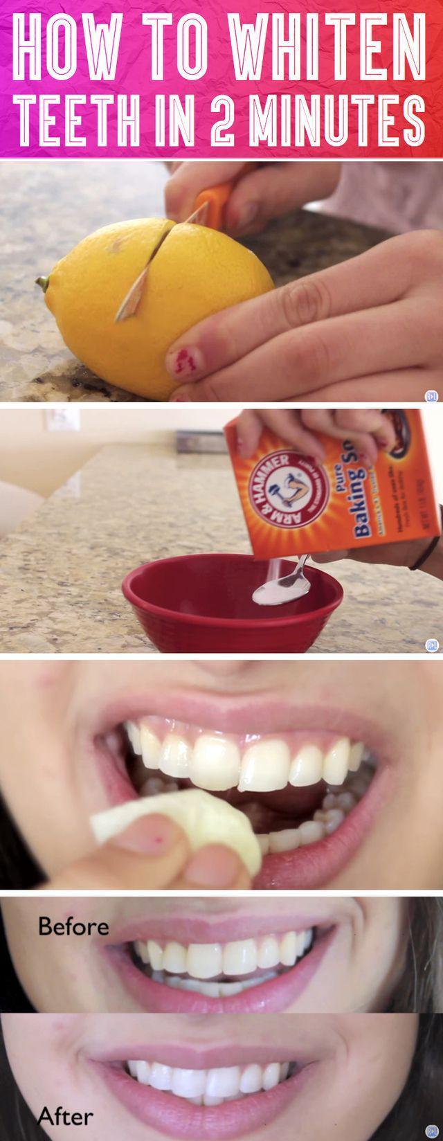 รูปภาพ:http://cutediyprojects.com/wp-content/uploads/2015/07/Woman-Finds-This-Strange-Trick-To-Whiten-Her-Teeth-In-2-Minutes-cover.jpg