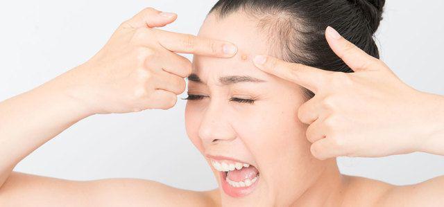 รูปภาพ:http://cdn2.stylecraze.com/wp-content/uploads/2012/07/Asian-woman-squeezing-pimples.jpg