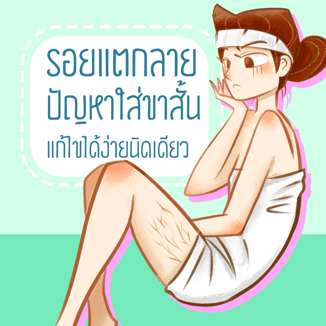 ภาพประกอบบทความ รอยแตกลาย ปัญหาใส่ขาสั้น แก้ไขได้ง่ายนิดเดียว