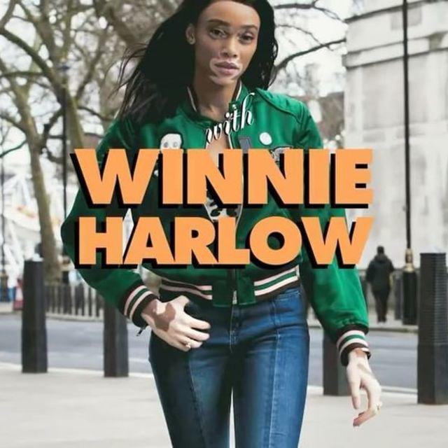 ตัวอย่าง ภาพหน้าปก:Winnie Harlow นางแบบสาวผู้ถ่ายทอดความรู้สึกสุดยูนีคให้กับ Converse Chuck Taylor All Star