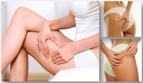 รูปภาพ:http://www.healthproductreviewcenter.com/wp-content/uploads/2014/04/home-remedies-to-get-rid-of-cellulite-on-thighs.png
