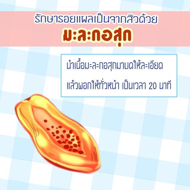 รูปภาพ: