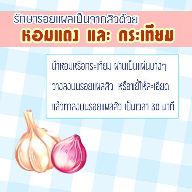 รูปภาพ: