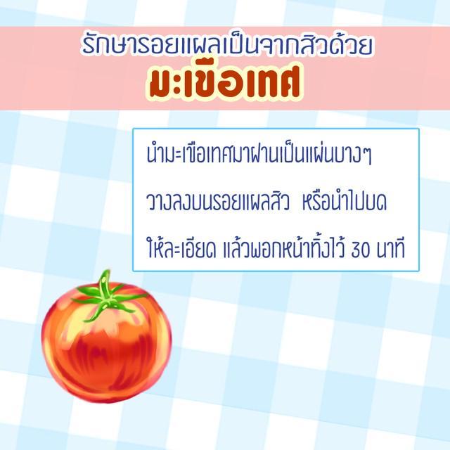 รูปภาพ: