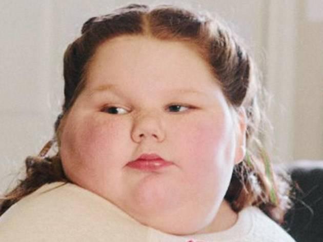 รูปภาพ:http://buzznews360.com/wp-content/uploads/2014/04/Calling-Young-Girls-Fat-Might-Make-Them-Obese-In-Their-Teenage-Years1.jpg