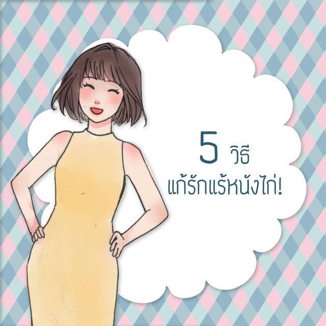 ภาพประกอบบทความ 5 วิธี แก้รักแร้หนังไก่!