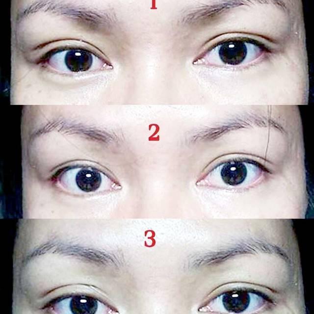 ภาพประกอบบทความ Howto : 4 วิธี ตาสองชั้นแบบง่ายๆ ไม่ง้อศัลยกรรม!!