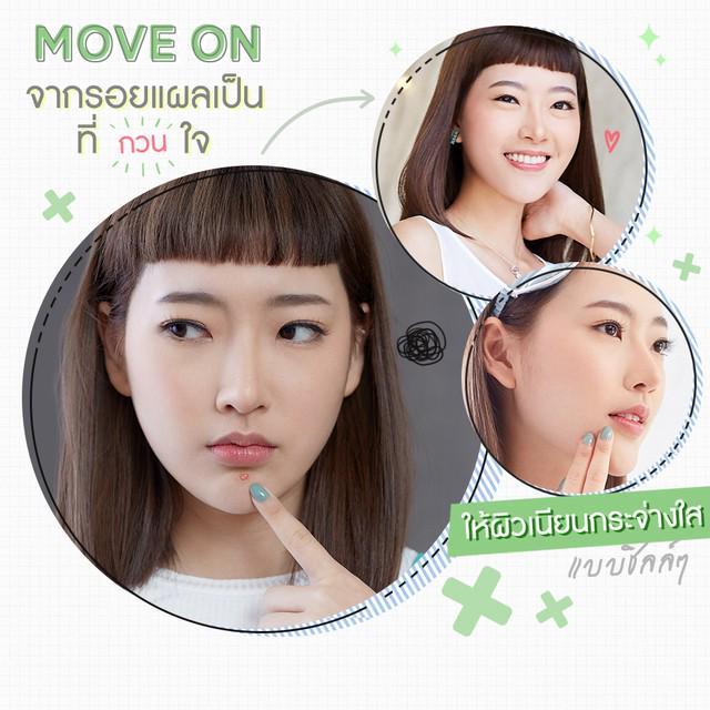 ตัวอย่าง ภาพหน้าปก:เรื่องสิว ใครว่าเรื่องใหญ่! Move on จากรอยแผลเป็นที่ (กวน) ใจ ให้ผิวกระจ่างใสแบบชิลล์ๆ ☆