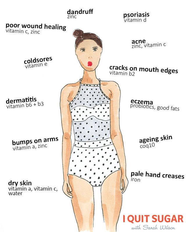 รูปภาพ:http://iquitsugar.com/wp-content/uploads/2015/02/Skin-nutritrional-deficiencies1-w-logo.jpg