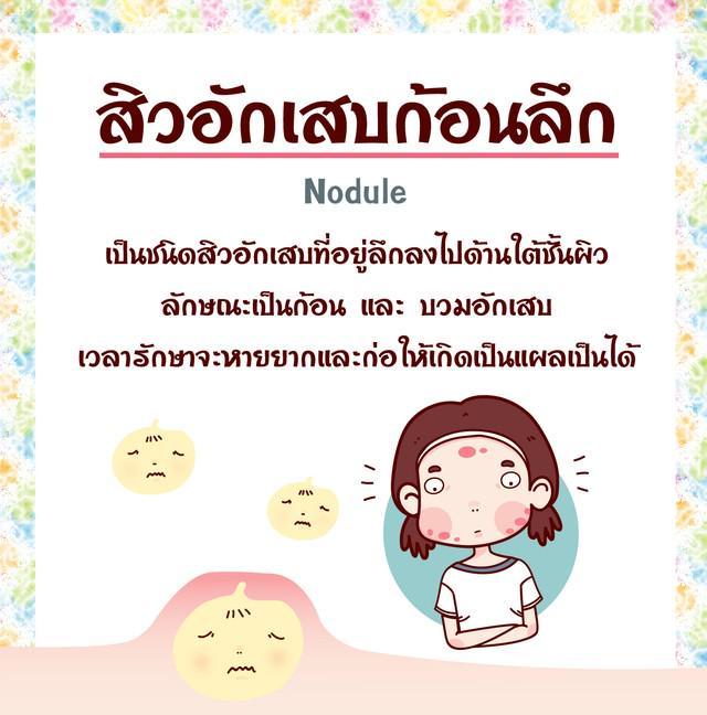 รูปภาพ: