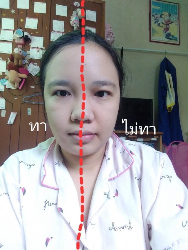 รูปภาพ: