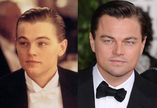 รูปภาพ:http://actsurgery.com/wp-content/uploads/2015/04/Leonardo-Dicaprio-Plastic-Surgeryt.jpg