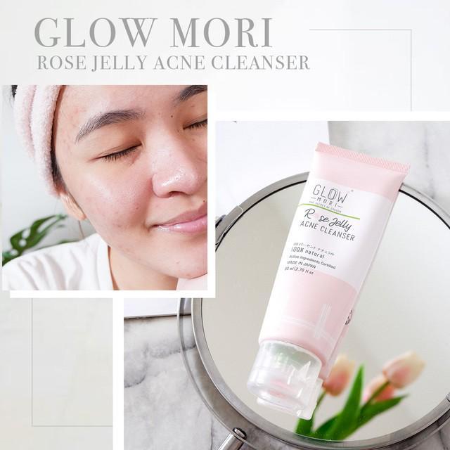 ภาพประกอบบทความ เก็บภาพ 1 เดือนที่ใช้ Rose Jelly Acne Cleanser จาก GLOW MORI✨💫