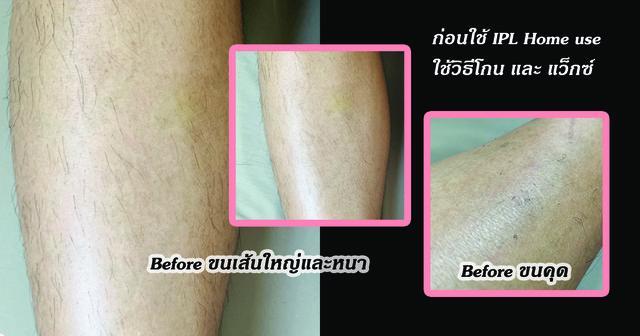 รูปภาพ: