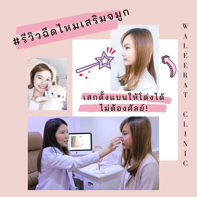 ภาพประกอบบทความ ไม่ต้องผ่า แค่ฉีด #รีวิวฉีดไหมเสริมจมูก เสกดั้งแบนให้โด่งได้ ไม่ต้องศัลย์!