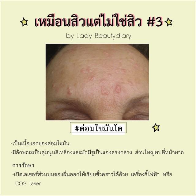 รูปภาพ: