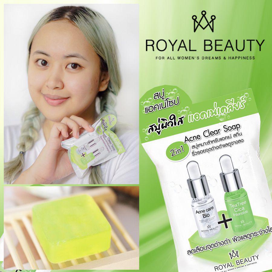 ภาพประกอบบทความ รีวิว Royal Beauty Acne Clear Soap สบู่กลีเซอรีน ลดสิว คลีนผิวสะอาดเวอร์! 