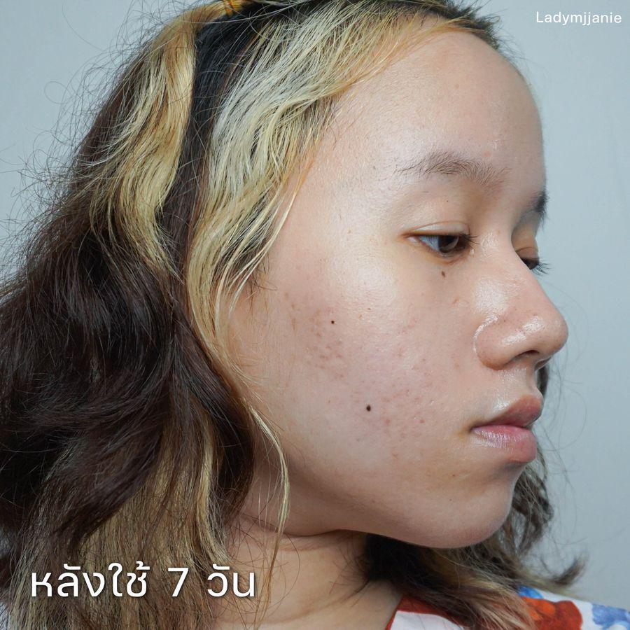 รูปภาพ: