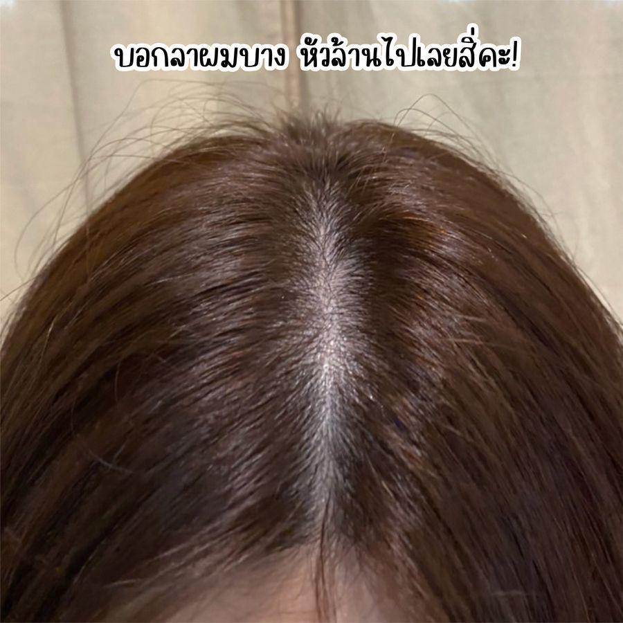 รูปภาพ: