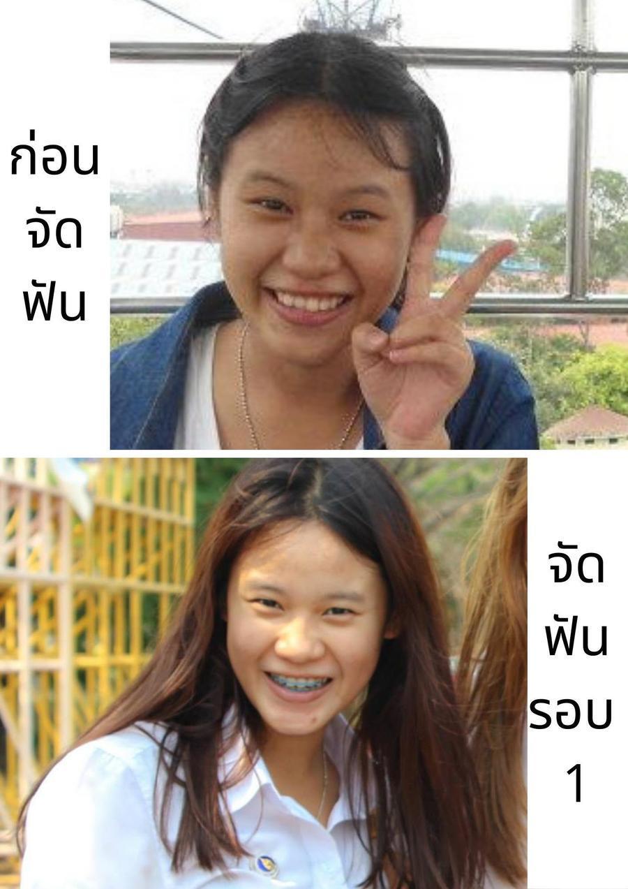 รูปภาพ: