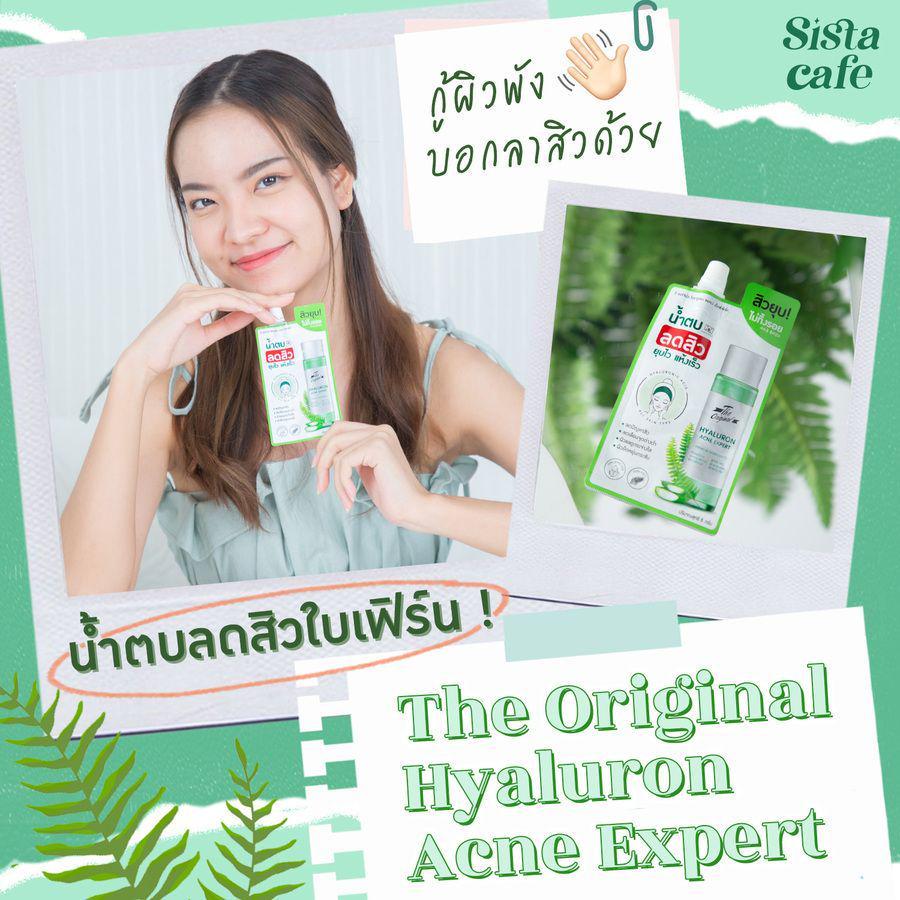 ตัวอย่าง ภาพหน้าปก:น้ำตบลดสิวใบเฟิร์น ! กู้ผิวพัง บอกลาสิวด้วย The Original Hyaluron Acne Expert