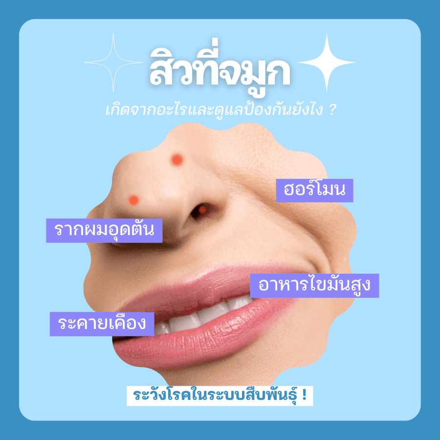 รูปภาพ: