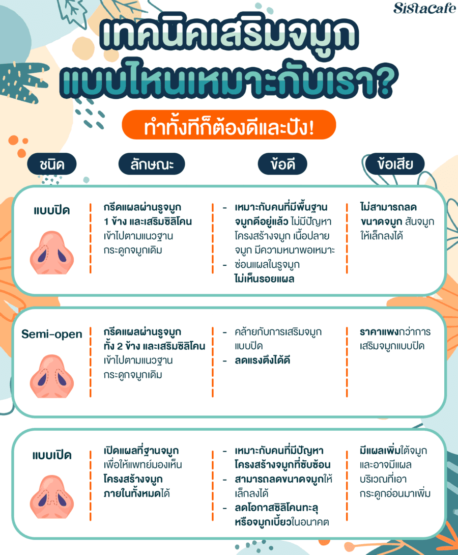 รูปภาพ: