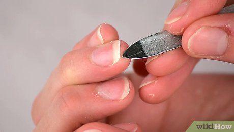 รูปภาพ:https://www.wikihow.com/images_en/thumb/1/12/Clean-Your-Fingernails-Step-1-Version-13.jpg/v4-460px-Clean-Your-Fingernails-Step-1-Version-13.jpg