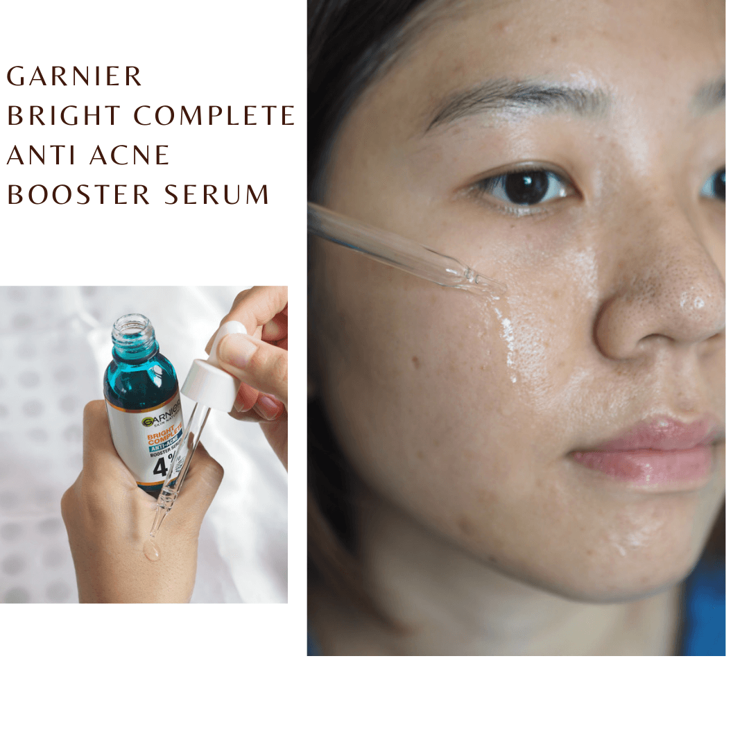 ภาพหน้าปก เปลี่ยนหน้าสิวให้เป็นหน้าใสด้วยคู่หู Garnier Bright Complete Anti Acne ตัวช่วยเรื่องสิว X2 ที่:2