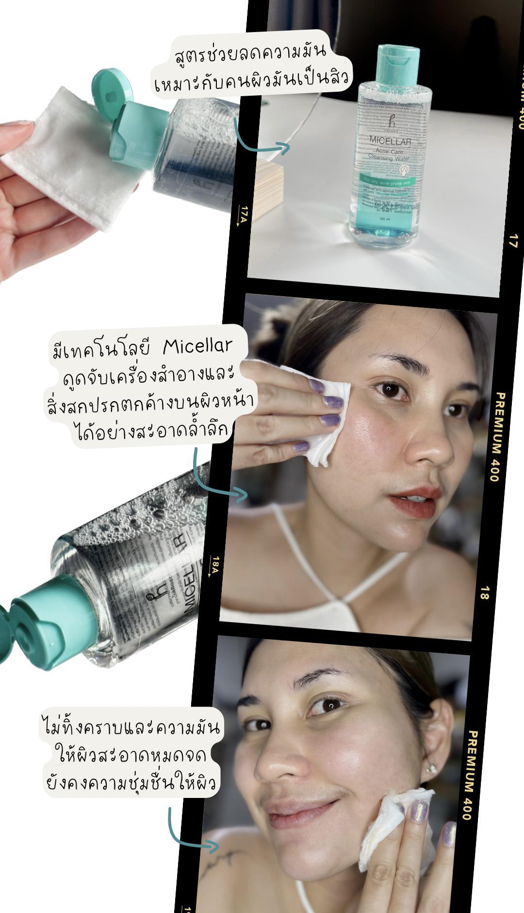 ภาพหน้าปก 💚 มัดรวมไอเทมน้องใหม่จาก 👉🏻 “Hanasol” acne&oil control ที่:2