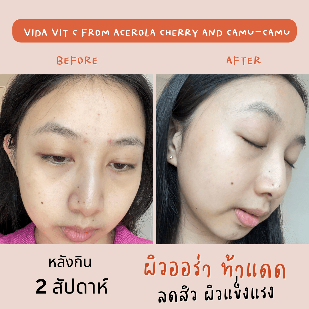 ภาพหน้าปก VIDA Vit C วิตามินซีธรรมชาติ ปกป้องและบำรุงผิวให้ออร่า ท้าแดด ที่:2