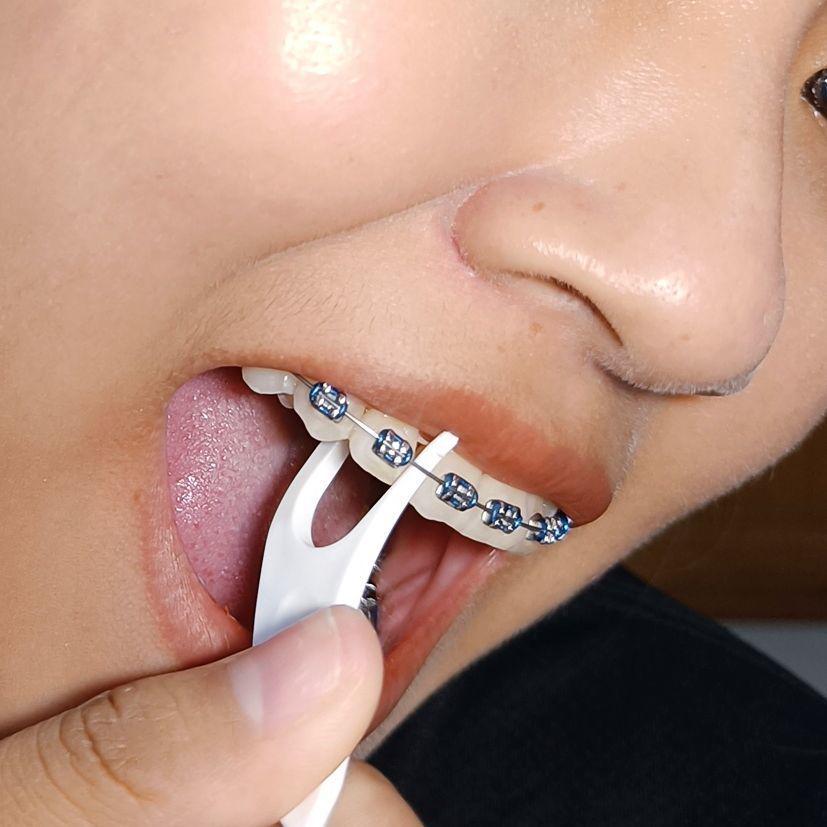ภาพหน้าปก ไอเทมลับ"ไหมขัดฟันสำหรับคนจัดฟัน"‼️ ที่:2