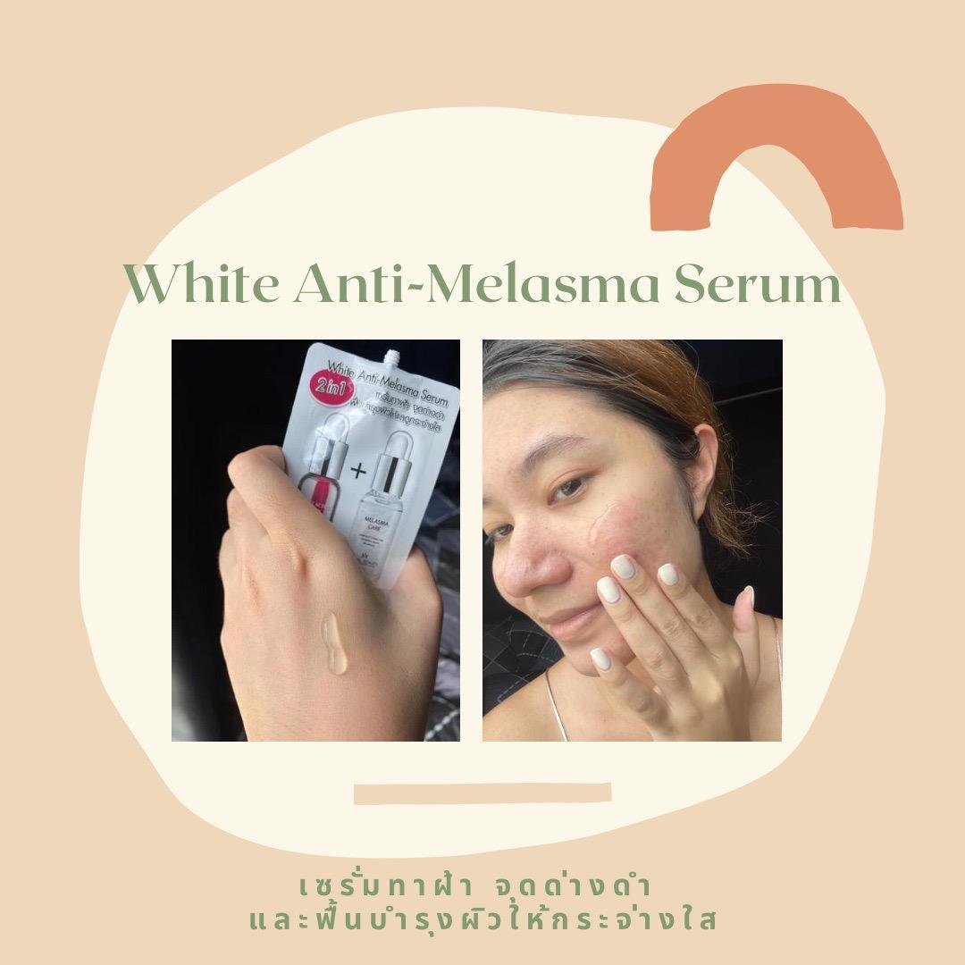 ภาพหน้าปก หน้าปังสู้ฟ้าฝน บอกลาฝ้ากระด้วย Royal Beauty White Anti-Melasma Serum ที่:1